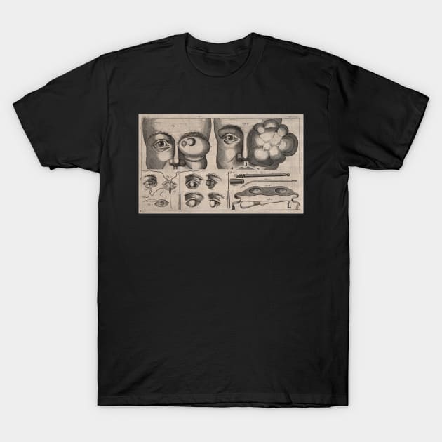 Surgical instruments, eye swell, Unknown T-Shirt by nickedenholm